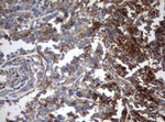 CD99 Antibody in Immunohistochemistry (Paraffin) (IHC (P))