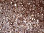 CD99 Antibody in Immunohistochemistry (Paraffin) (IHC (P))