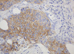 CD99 Antibody in Immunohistochemistry (Paraffin) (IHC (P))