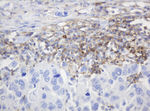 CD99 Antibody in Immunohistochemistry (Paraffin) (IHC (P))