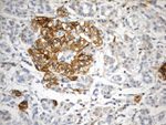 CD99 Antibody in Immunohistochemistry (Paraffin) (IHC (P))