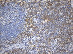 CD99 Antibody in Immunohistochemistry (Paraffin) (IHC (P))