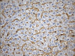 CD99 Antibody in Immunohistochemistry (Paraffin) (IHC (P))