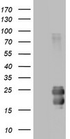 CD99 Antibody in Western Blot (WB)