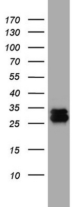 CD99 Antibody in Western Blot (WB)