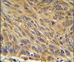 CD99L2 Antibody in Immunohistochemistry (IHC)