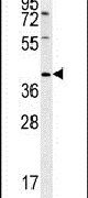 CD99L2 Antibody in Western Blot (WB)