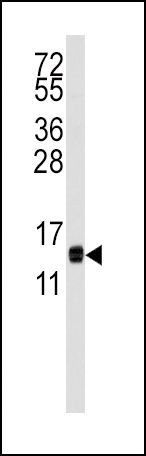 CDA Antibody in Western Blot (WB)