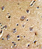 Cdc23 Antibody in Immunohistochemistry (IHC)