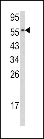 Cdc23 Antibody in Western Blot (WB)