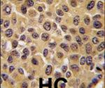 Cdc25B Antibody in Immunohistochemistry (IHC)