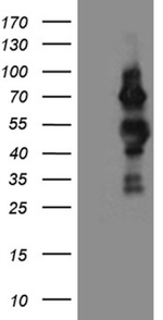 CDC25B Antibody in Western Blot (WB)