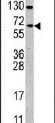 Cdc25B Antibody in Western Blot (WB)