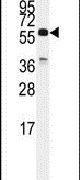 Cdc25C Antibody in Western Blot (WB)
