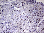 CDCA7L Antibody in Immunohistochemistry (Paraffin) (IHC (P))