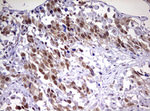 CDCA7L Antibody in Immunohistochemistry (Paraffin) (IHC (P))