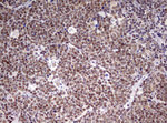 CDCA7L Antibody in Immunohistochemistry (Paraffin) (IHC (P))