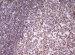 CDCA7L Antibody in Immunohistochemistry (Paraffin) (IHC (P))