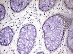 CDCA7L Antibody in Immunohistochemistry (Paraffin) (IHC (P))