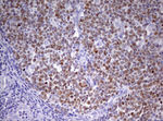 CDCA7L Antibody in Immunohistochemistry (Paraffin) (IHC (P))