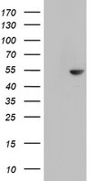 CDCA7L Antibody in Western Blot (WB)