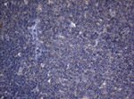 CDCA8 Antibody in Immunohistochemistry (Paraffin) (IHC (P))