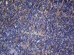 CDCA8 Antibody in Immunohistochemistry (Paraffin) (IHC (P))