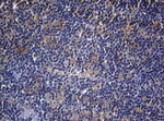 CDCA8 Antibody in Immunohistochemistry (Paraffin) (IHC (P))