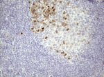 CDCA8 Antibody in Immunohistochemistry (Paraffin) (IHC (P))