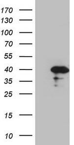 CDCA8 Antibody in Western Blot (WB)