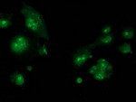 CDCP1 Antibody in Immunocytochemistry (ICC/IF)