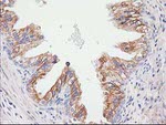 CDCP1 Antibody in Immunohistochemistry (Paraffin) (IHC (P))