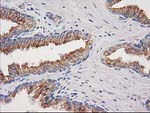 CDCP1 Antibody in Immunohistochemistry (Paraffin) (IHC (P))