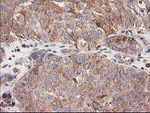 CDCP1 Antibody in Immunohistochemistry (Paraffin) (IHC (P))