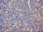 CDCP1 Antibody in Immunohistochemistry (Paraffin) (IHC (P))