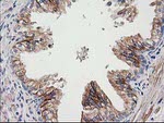 CDCP1 Antibody in Immunohistochemistry (Paraffin) (IHC (P))