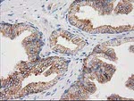 CDCP1 Antibody in Immunohistochemistry (Paraffin) (IHC (P))