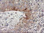 CDCP1 Antibody in Immunohistochemistry (Paraffin) (IHC (P))