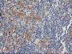 CDCP1 Antibody in Immunohistochemistry (Paraffin) (IHC (P))