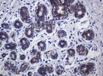 CDH1 Antibody in Immunohistochemistry (Paraffin) (IHC (P))