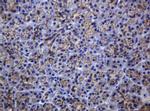CDH1 Antibody in Immunohistochemistry (Paraffin) (IHC (P))