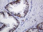 CDH1 Antibody in Immunohistochemistry (Paraffin) (IHC (P))