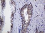 CDH1 Antibody in Immunohistochemistry (Paraffin) (IHC (P))