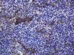 CDH1 Antibody in Immunohistochemistry (Paraffin) (IHC (P))