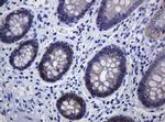 CDH1 Antibody in Immunohistochemistry (Paraffin) (IHC (P))