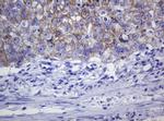CDH1 Antibody in Immunohistochemistry (Paraffin) (IHC (P))