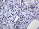 CDH1 Antibody in Immunohistochemistry (Paraffin) (IHC (P))