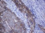 CDH1 Antibody in Immunohistochemistry (Paraffin) (IHC (P))