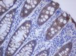 CDH1 Antibody in Immunohistochemistry (Paraffin) (IHC (P))