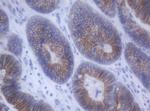 CDH1 Antibody in Immunohistochemistry (Paraffin) (IHC (P))